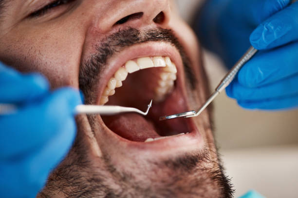 Best Emergency Dentist for Knocked-Out Tooth in Rowland, NC